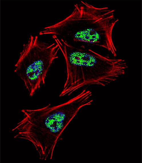 Polyclonal Rabbit anti-Human PROX1 Antibody (aa492-522, IHC, IF, WB)