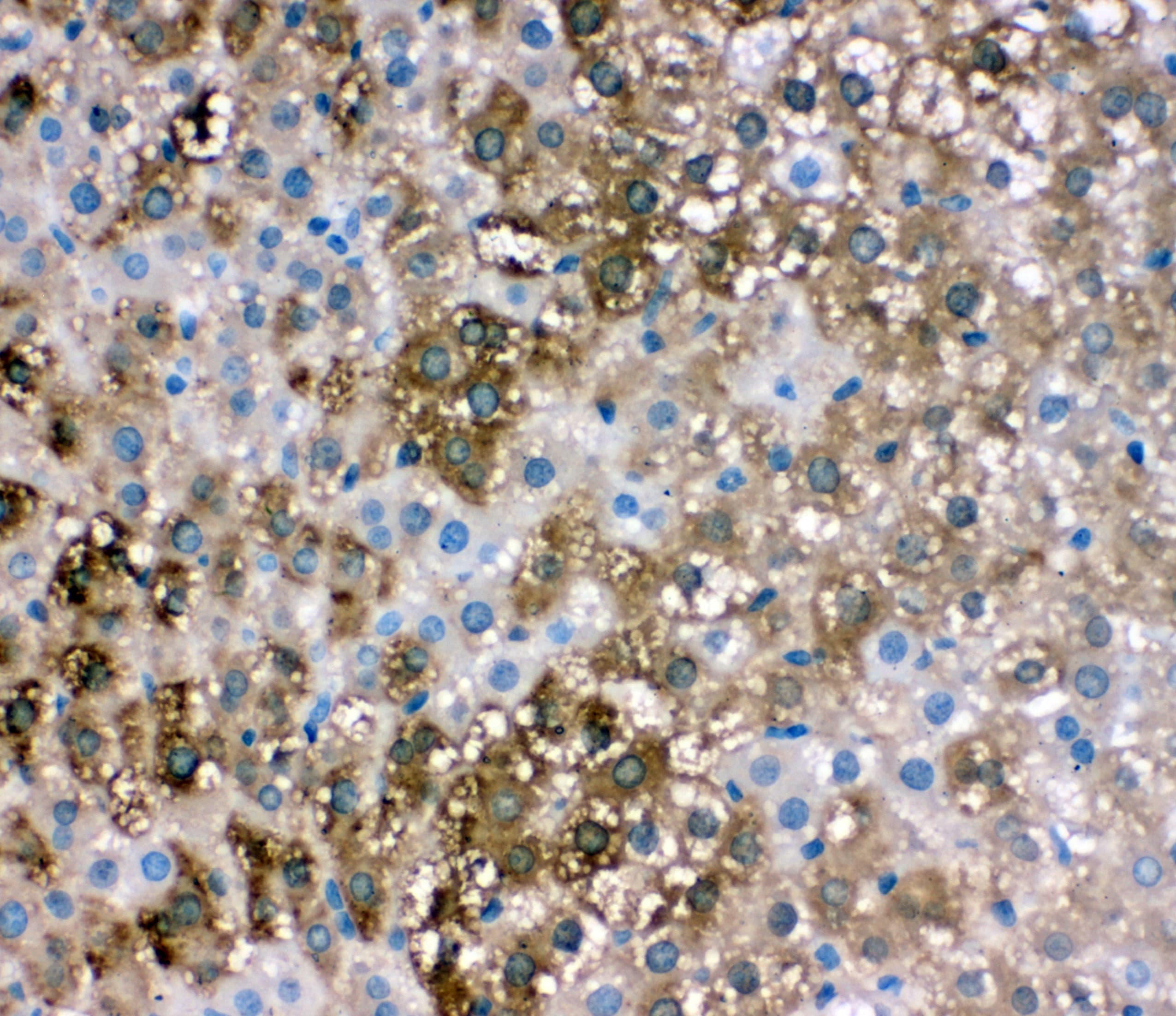 FABP1 / L-FABP Antibody (aa30-46)