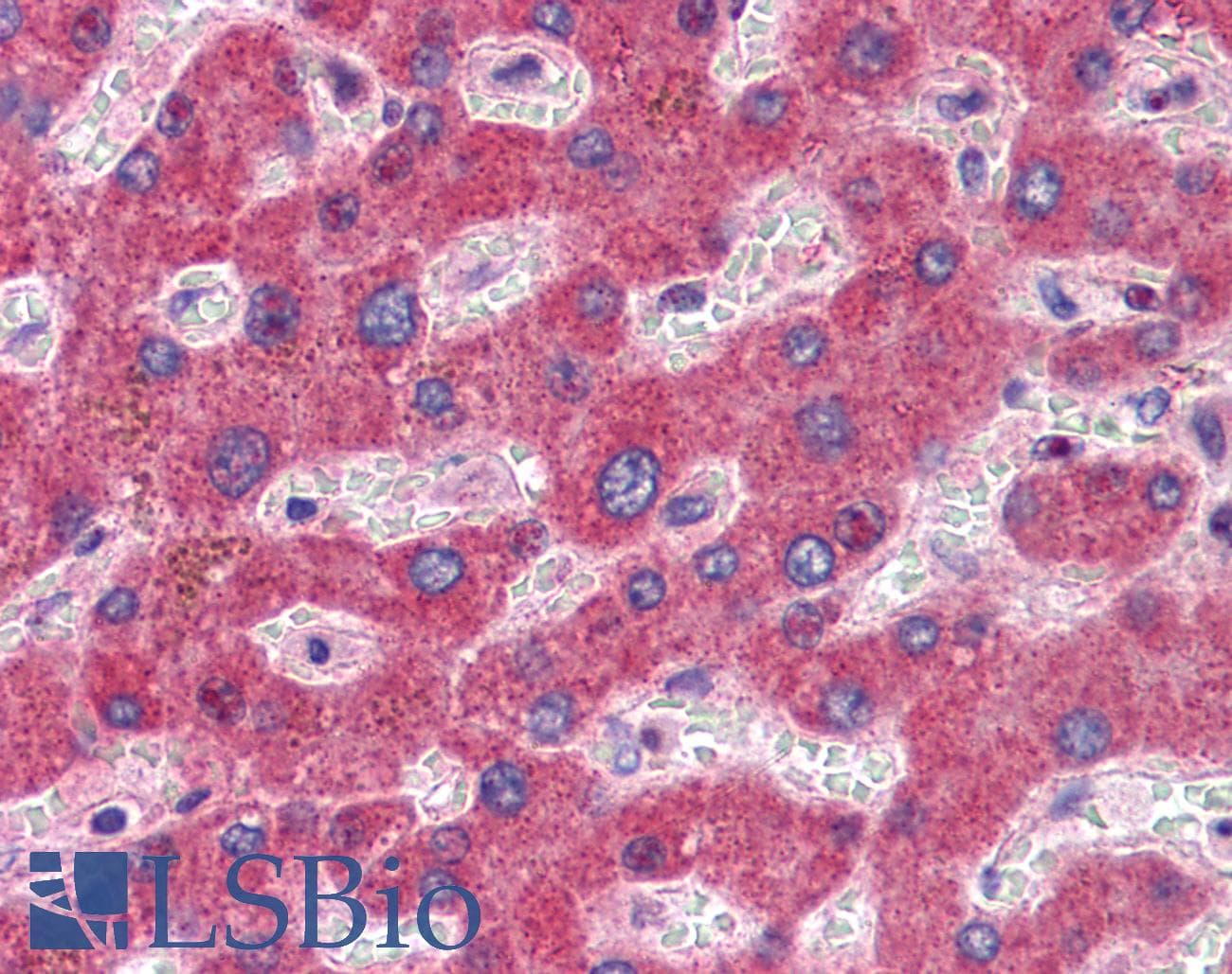 IHC-plus™ GFPT1 / GFAT Antibody (C-Terminus)