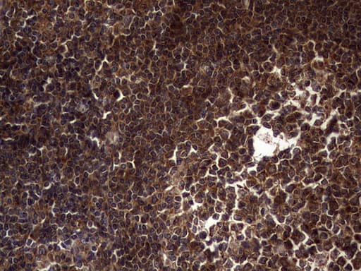 DOCK8 Antibody (aa832-1160, clone OTI4H10)
