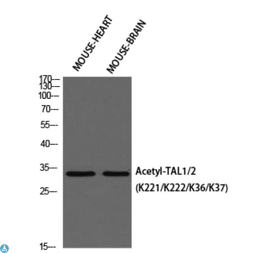 Polyclonal Rabbit anti-Human TAL1 Antibody (WB)