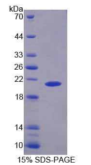 Rat PYGL Protein (Recombinant His)