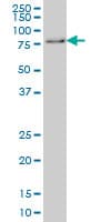 IHC-plus™ Monoclonal Mouse anti-Human GMEB1 Antibody (clone 2A8, IHC, IF, WB)