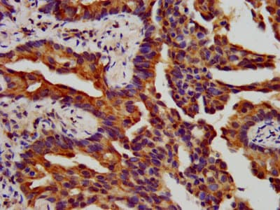 ITGB6 / Integrin Beta 6 Antibody