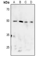 Polyclonal Rabbit anti-Human MAPKAPK2 / MAPKAP Kinase 2 Antibody (IHC, WB)