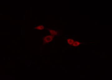 Polyclonal Rabbit anti-Human TNFRSF1B / TNFR2 Antibody (IF, WB)