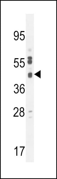 SLC35F6 Antibody (aa329-358)
