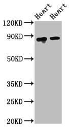 ACO2 / Aconitase 2 Antibody