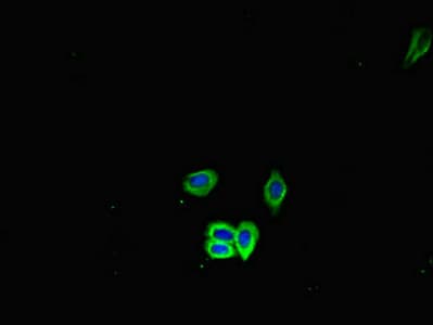 HSPA5 / GRP78 / BiP Antibody