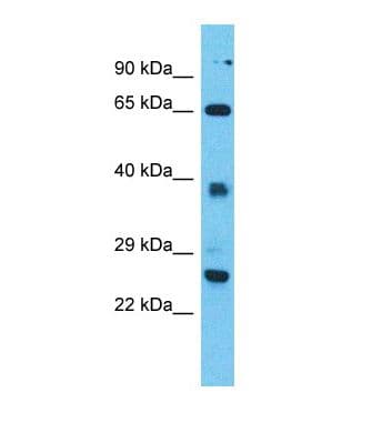 TTC26 Antibody (N-Terminus)