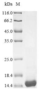 Nostoc ellipsosporum Cyanovirin-N (N ellipsosporum) Protein (Recombinant 6His, N-terminus)