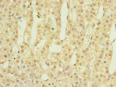 LOH12CR1 Antibody