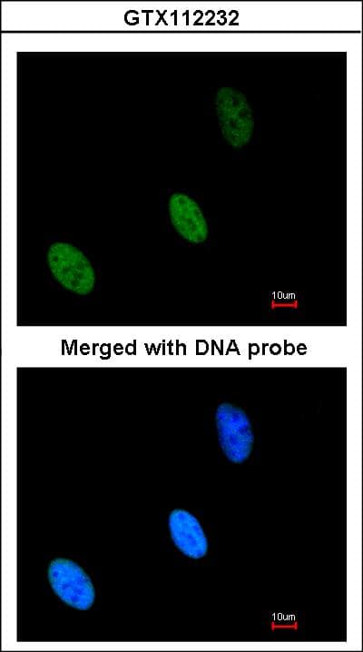 Polyclonal Rabbit anti-Human ZHX2 / RAF Antibody (aa533-826, IHC, WB)