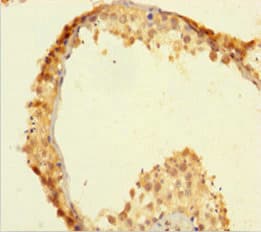 Polyclonal Rabbit anti-Human ZSCAN20 Antibody (aa1-433, WB)