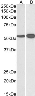 IHC-plus™ GLUD1/Glutamate Dehydrogenase Antibody (aa93-107)