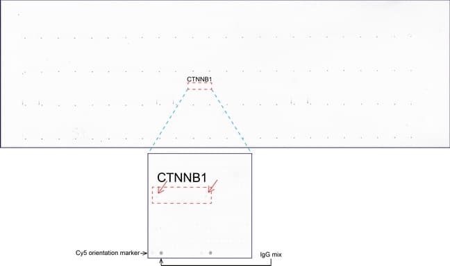 CTNNB1 / Beta Catenin Antibody (clone UMAB14, Carrier-free)