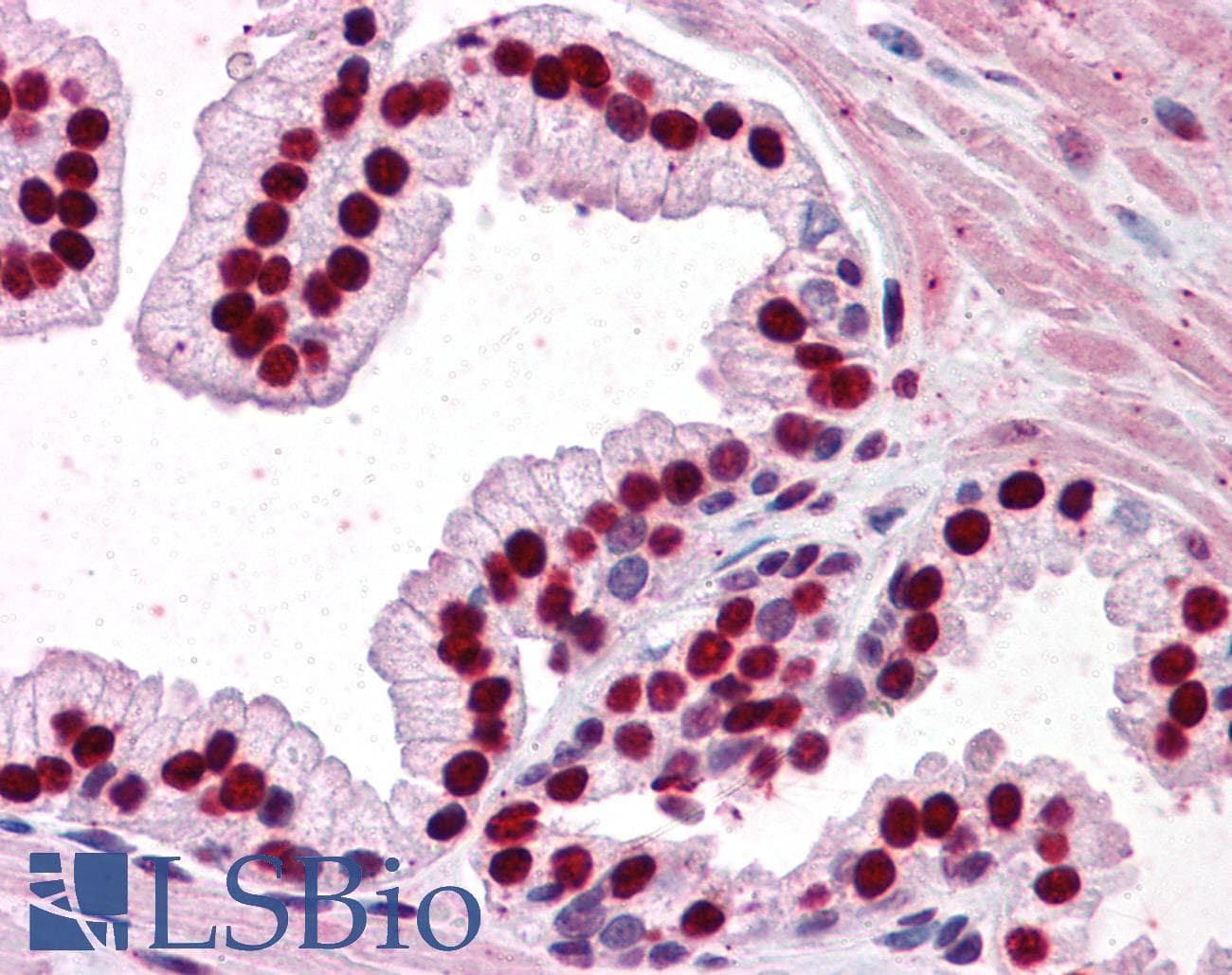 IHC-plus™ Monoclonal Mouse anti-Human SMAD6 Antibody (clone 1G2, IHC, WB)