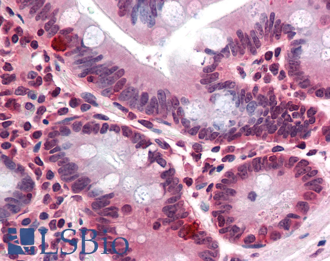 IHC-plus™ CDCP1 Antibody (Internal)