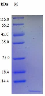 Human CXCL3 / GRO Gamma Protein (Recombinant)