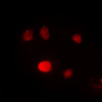 SPI1 / PU.1 Antibody (Internal)