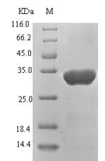 Hepatitis B Virus HBV X Protein (Recombinant 6His-SUMO, N-terminus)