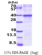 Human CTGF Protein (Recombinant His)