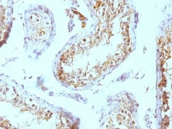 HSPG2 / Perlecan Antibody (clone SPM255)