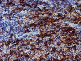 ALOX15 / 15-Lipoxygenase Antibody (clone OTI2G3)