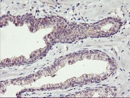 TMEFF2 Antibody (clone OTI1F9)