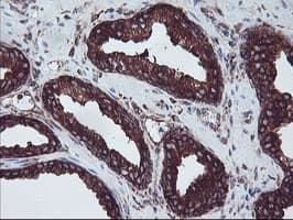 SULT1A1 / Sulfotransferase 1A1 Antibody (clone OTI5A1)