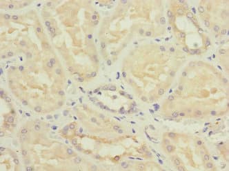 NME3 Antibody