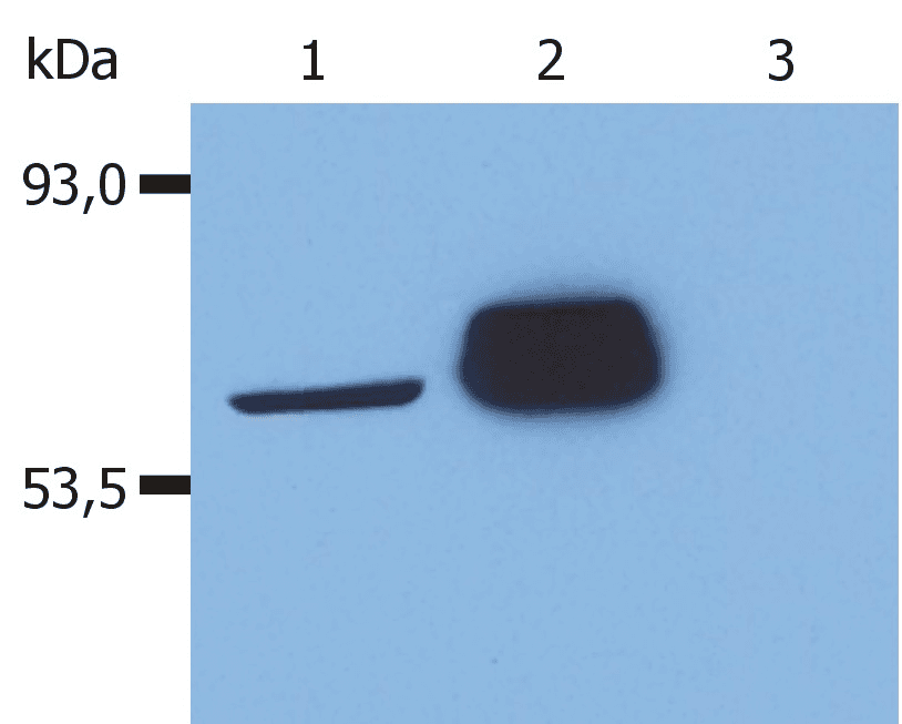 p56lck / LCK Antibody (aa22-36, clone LCK-01)