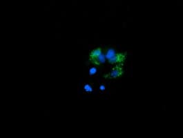 PROSC Antibody (clone OTI1G2)
