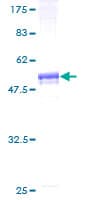Human SLC23A1 / SVCT1 Protein (Recombinant GST)