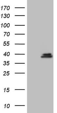 GEMIN8 Antibody (clone OTI2F5)