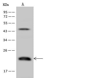 Polyclonal Rabbit anti-Human TMEM109 Antibody (WB)