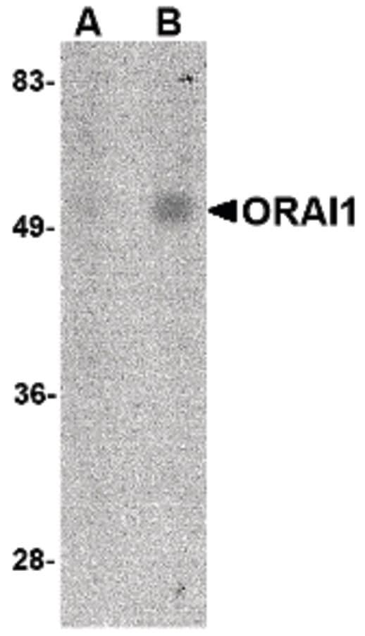 TMEM142A / ORAI1 Antibody (clone 6D11A11)