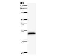 GOLGB1 / Giantin Antibody (clone 2388C3a)
