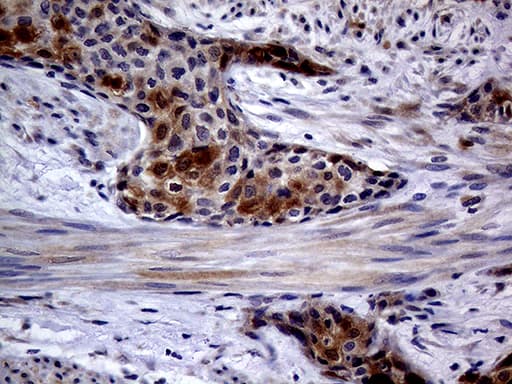 p16INK4a / CDKN2A Antibody (clone OTI10F12)