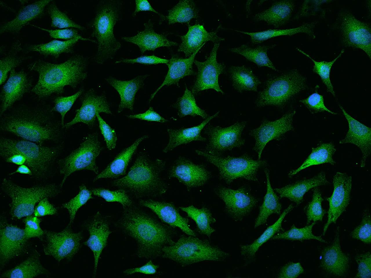 NAA10 / ARD1A Antibody (Preservative Free)