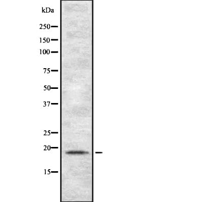 TSPO / PBR Antibody