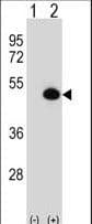 ASS1 / ASS Antibody (aa281-310)