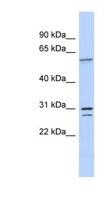 Polyclonal Rabbit anti-Human TRNAU1AP / TRSPAP1 Antibody (aa71-120, WB)