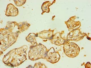 Polyclonal Rabbit anti-Human BAG5 Antibody (aa198-447, IHC, WB)