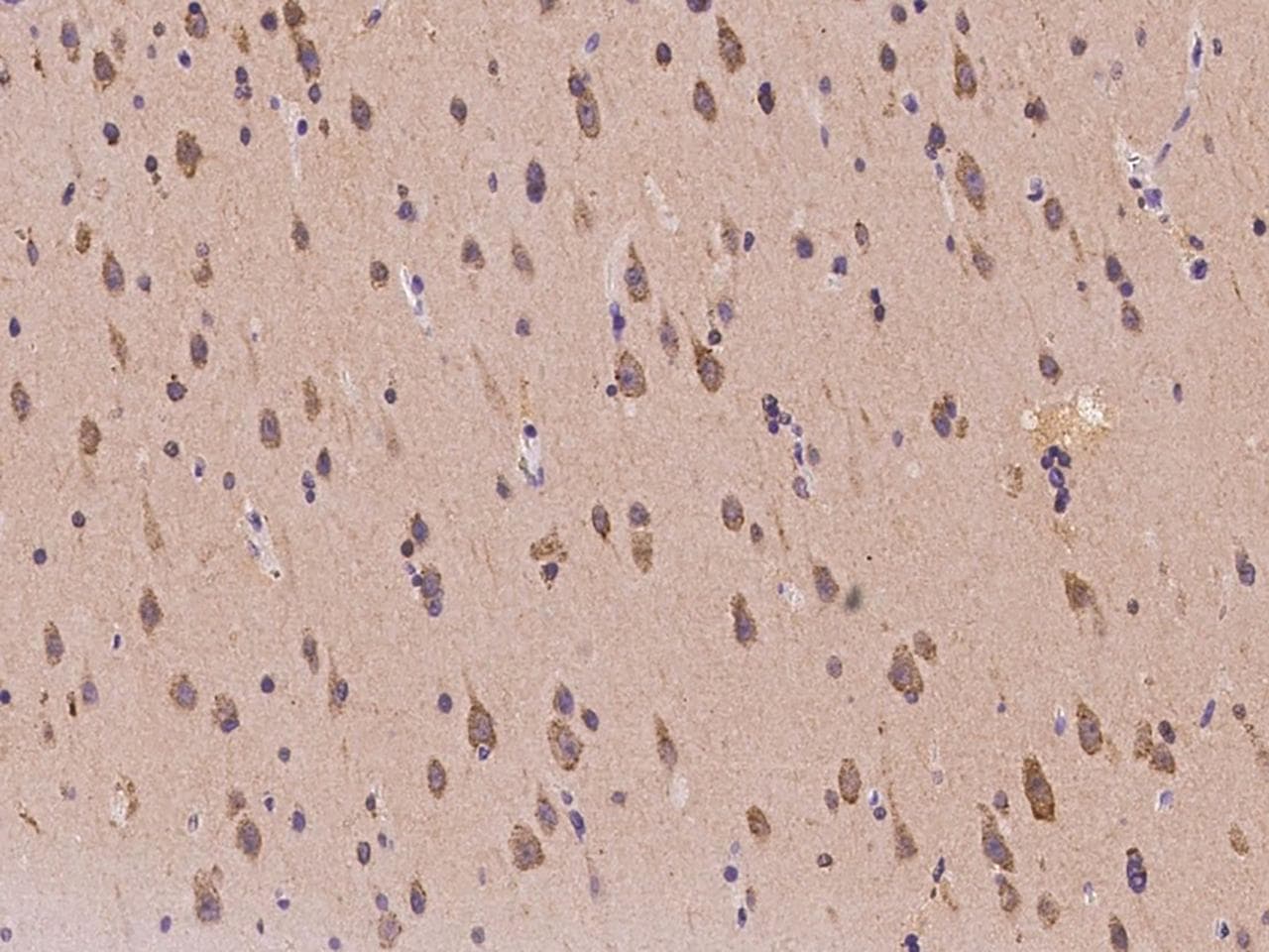 SIMPL / IRAK1BP1 Antibody