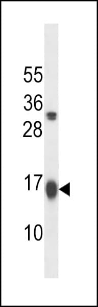 GABARAPL2 / ATG8 Antibody (aa1-28)