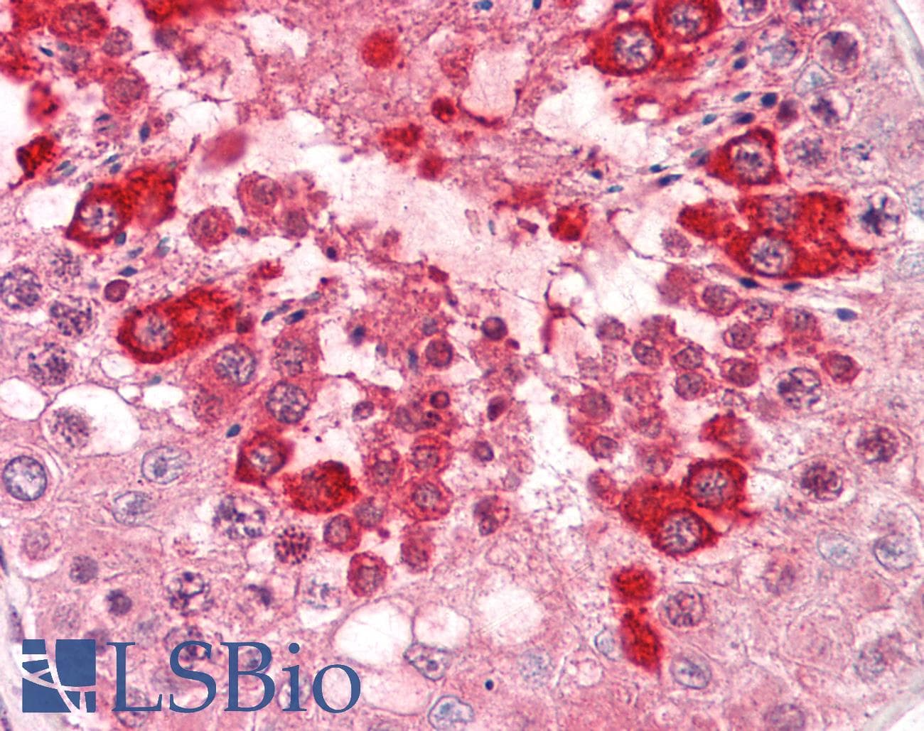 IHC-plus™ Polyclonal Rabbit anti-Human CLEC7A / Dectin 1 Antibody (IHC, IF, WB)