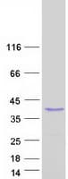 Human SMAD6 Protein (Recombinant Myc-DDK (Flag))