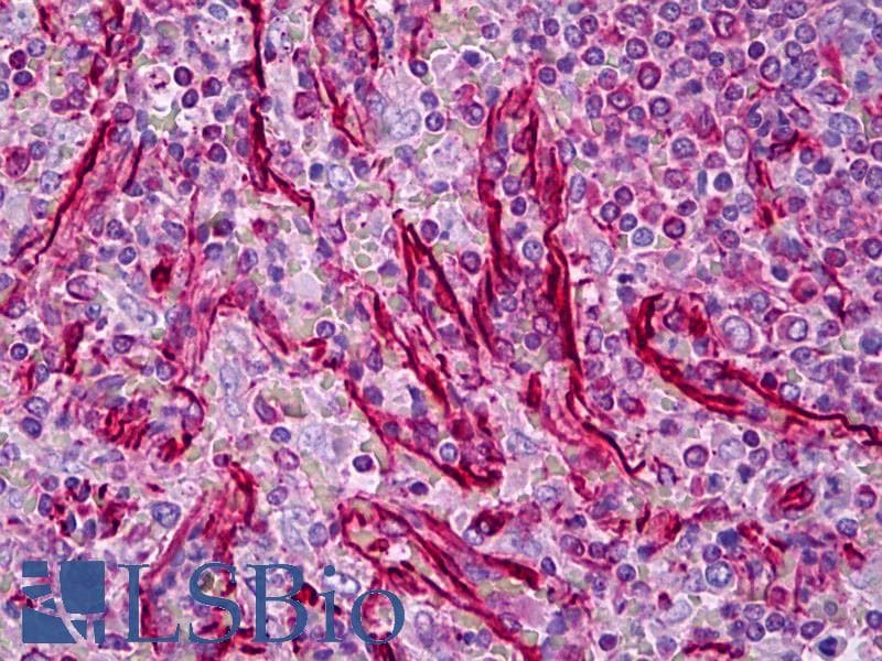 PathPlus™ Vimentin Antibody (clone 23H2)