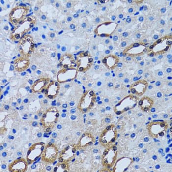 Polyclonal Rabbit anti-Human IMPA1 / IMP Antibody (IHC, IF, WB)
